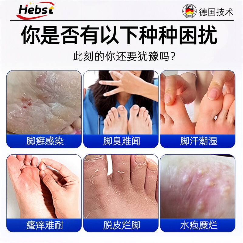 HEBST 1- HEBST脚气喷雾剂脚臭止痒脱皮烂脚丫真菌感染脚气专用 通用规格,1/盒