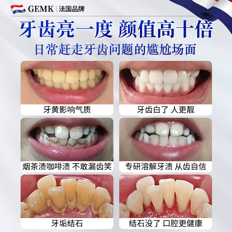 AULESET美亮白牙粉去口臭祛黄去牙渍去烟渍牙结石洁洗牙粉膏碳酸钙植酸钠 6955096348281/瓶